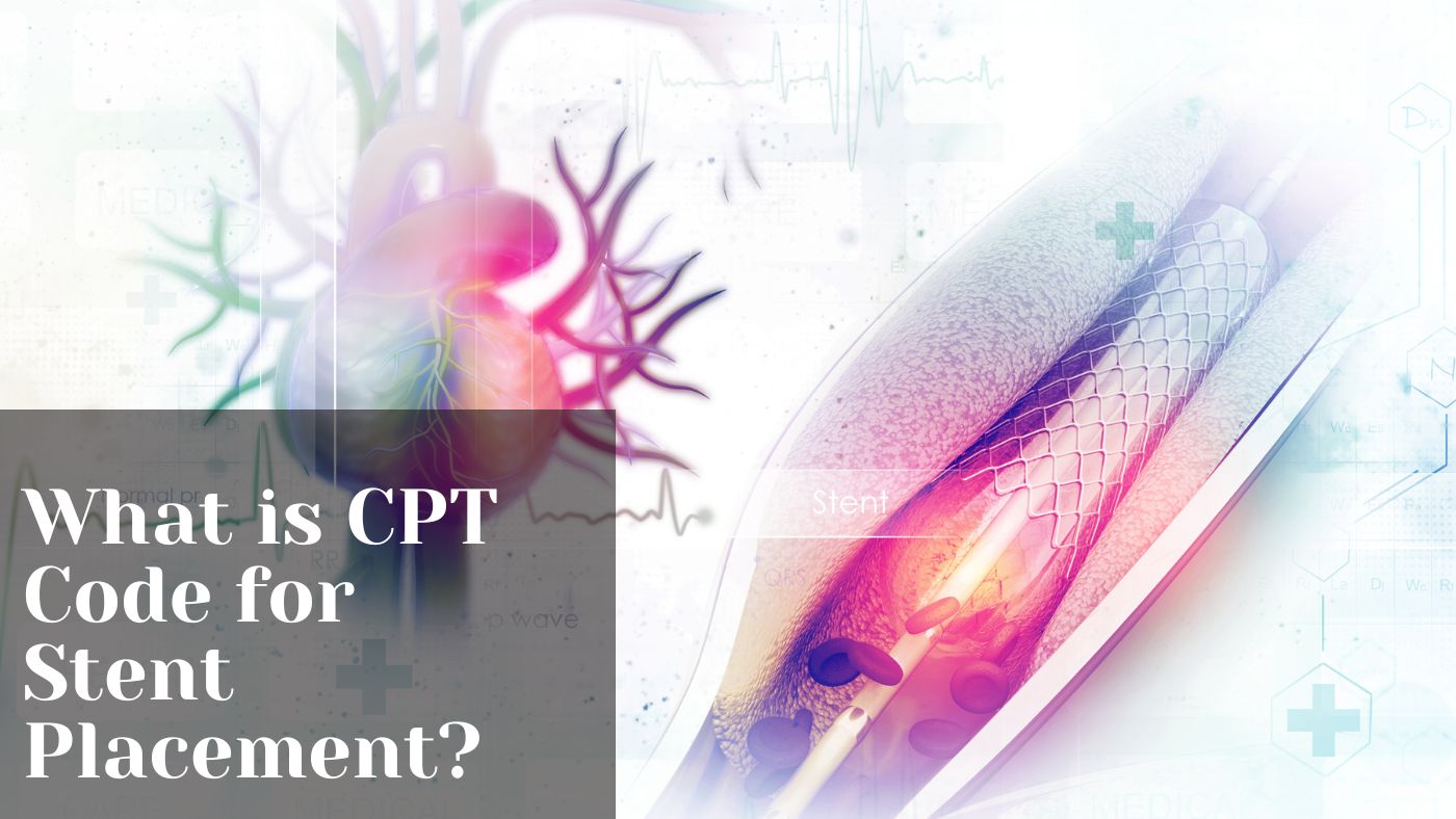 What is CPT Code for Stent Placement?